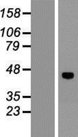 Novus Biologicals&trade;&nbsp;VSIG8 Overexpression Lysate