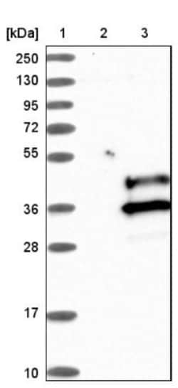 VSTM2A Antibody, Novus Biologicals 0.1mL; Unlabeled:Antibodies, Polyclonal