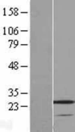Novus Biologicals VSTM2A Overexpression Lysate 0.1 mg | Buy Online | Novus Biologicals&trade; | Fisher Scientific