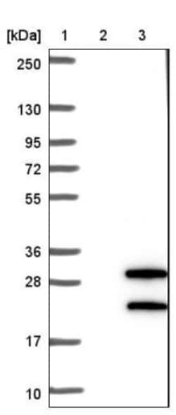 VSTM2L Antibody, Novus Biologicals 0.1mL; Unlabeled:Antibodies, Polyclonal