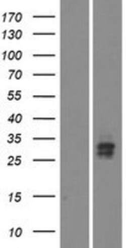 Novus Biologicals&trade;&nbsp;VSTM5 Overexpression Lysate