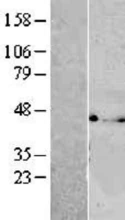 Novus Biologicals™ VTA1 Overexpression Lysate