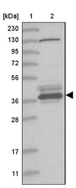 VTA1 Antibody, Novus Biologicals 0.1mL; Unlabeled:Antibodies, Polyclonal