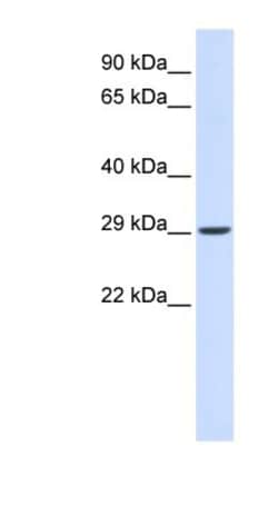 VTI1A Antibody, Novus Biologicals:Antibodies:Primary Antibodies