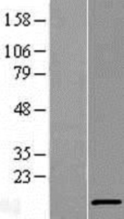 Novus Biologicals&trade;&nbsp;V-type proton ATPase subunit F Overexpression Lysate