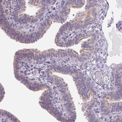 VWA3B Antibody, Novus Biologicals 0.1mL; Unlabeled:Antibodies, Polyclonal