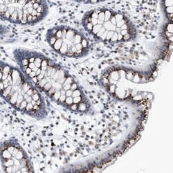 VWA5B2 Antibody, Novus Biologicals 25 &mu;L; Unlabeled:Antibodies, Polyclonal