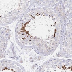 VWC2L Antibody, Novus Biologicals 0.1mL; Unlabeled:Antibodies, Polyclonal