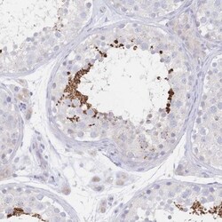 VWC2L Antibody, Novus Biologicals 0.1mL; Unlabeled:Antibodies, Polyclonal
