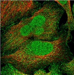 VWCE Antibody, Novus Biologicals 25ul | Buy Online | Novus Biologicals | Fisher Scientific