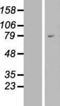 Novus Biologicals&trade;&nbsp;WAC Overexpression Lysate