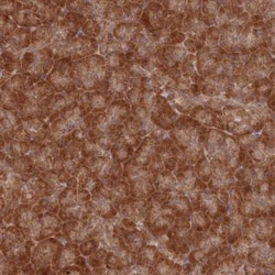 WAPL Antibody, Novus Biologicals 25 &mu;L, Unlabeled:Antibodies, Polyclonal