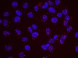 WAPL Antibody, Novus Biologicals 0.1mg; Unlabeled:Antibodies, Polyclonal