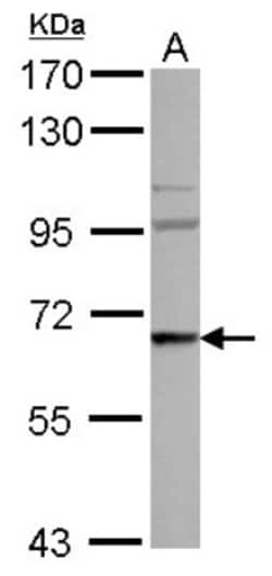 WASF3/WAVE3 Antibody, Novus Biologicals 0.1mL; Unlabeled:Antibodies, Polyclonal