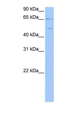 WASF3/WAVE3 Antibody, Novus Biologicals 100&mu;L; Unlabeled:Antibodies,