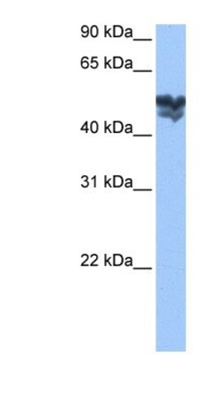 WASF3/WAVE3 Antibody, Novus Biologicals 100&mu;L; Unlabeled:Antibodies,