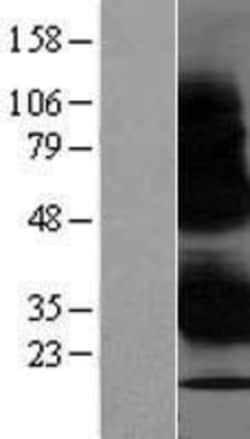 Novus Biologicals&trade;&nbsp;WBP1 Overexpression Lysate