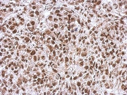 WBP11 Antibody, Novus Biologicals 0.1mL; Unlabeled:Antibodies, Polyclonal