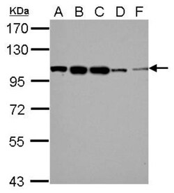 WBP11 Antibody, Novus Biologicals 0.1mL; Unlabeled:Antibodies, Polyclonal