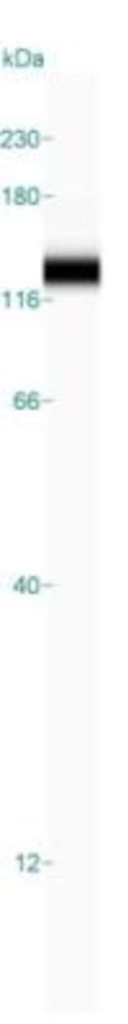 WBP11 Antibody, Novus Biologicals 25 &mu;L, Unlabeled:Antibodies, Polyclonal