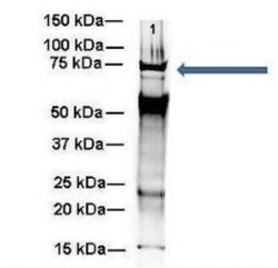 WBP11 Antibody, Novus Biologicals 20&mu;L; Unlabeled:Antibodies, Polyclonal