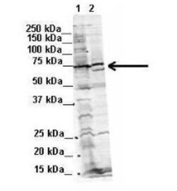 WBP11 Antibody, Novus Biologicals 20&mu;L; Unlabeled:Antibodies, Polyclonal