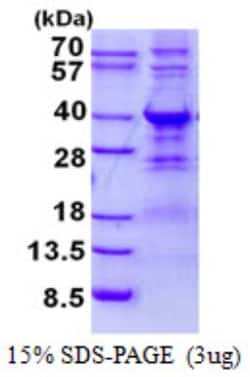Novus Biologicals&trade;&nbsp;Recombinant Human WBP2 His Protein