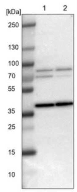 WBSCR17 Antibody, Novus Biologicals:Antibodies:Primary Antibodies