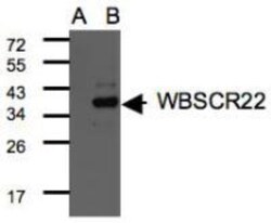 WBSCR22 Antibody, Novus Biologicals 0.1mL; Unlabeled:Antibodies, Polyclonal