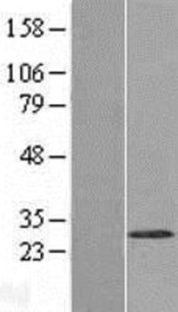 Novus Biologicals™ WBSCR27 Overexpression Lysate