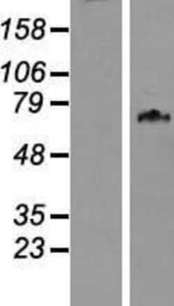 Novus Biologicals&trade;&nbsp;WDPCP Overexpression Lysate