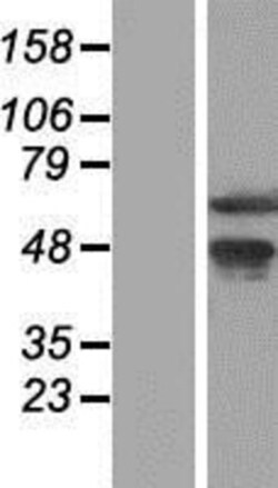 Novus Biologicals&trade;&nbsp;WDR13 Overexpression Lysate