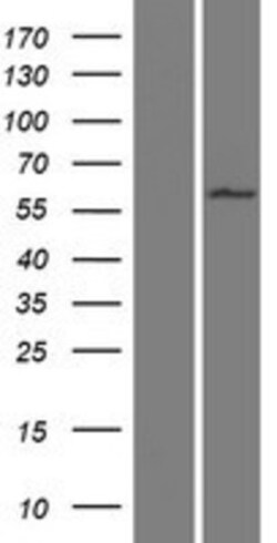 Novus Biologicals&trade;&nbsp;WDR16 Overexpression Lysate