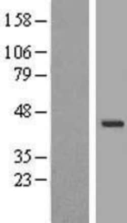 Novus Biologicals&trade;&nbsp;WDR31 Overexpression Lysate