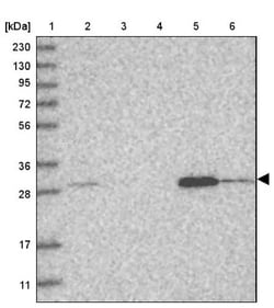 WDR33 Antibody, Novus Biologicals 0.1mL; Unlabeled:Antibodies, Polyclonal
