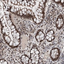 WDR33 Antibody, Novus Biologicals 0.1mL; Unlabeled:Antibodies, Polyclonal