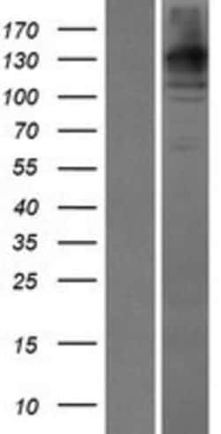 Novus Biologicals&trade;&nbsp;WDR35 Overexpression Lysate