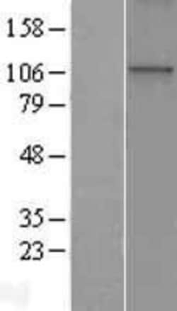 Novus Biologicals&trade;&nbsp;WDR36 Overexpression Lysate