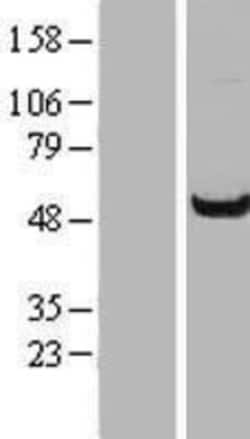 Novus Biologicals™ WDR37 Overexpression Lysate