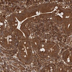 WDR37 Antibody, Novus Biologicals:Antibodies:Primary Antibodies