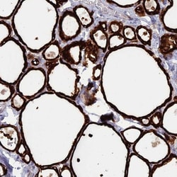 WDR46 Antibody, Novus Biologicals:Antibodies:Primary Antibodies