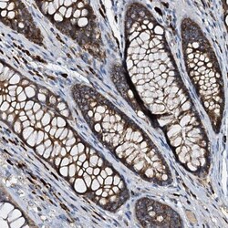 WDR51A Antibody, Novus Biologicals 0.1mL; Unlabeled:Antibodies, Polyclonal