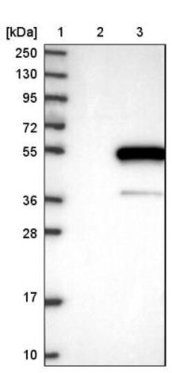 WDR51A Antibody, Novus Biologicals 0.1mL; Unlabeled:Antibodies, Polyclonal