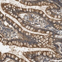 WDR53 Antibody, Novus Biologicals 0.1mL; Unlabeled:Antibodies, Polyclonal