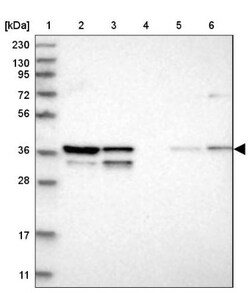 WDR57 Antibody, Novus Biologicals 0.1mL; Unlabeled:Antibodies, Polyclonal