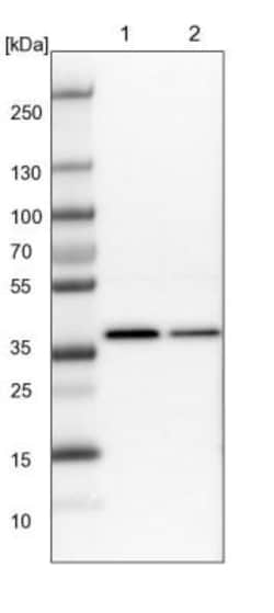 WDR57 Antibody, Novus Biologicals 0.1mL; Unlabeled:Antibodies, Polyclonal