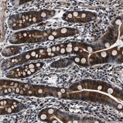 WDR60 Antibody, Novus Biologicals 0.1mL; Unlabeled:Antibodies, Polyclonal