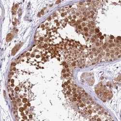 WDR61 Antibody, Novus Biologicals:Antibodies:Primary Antibodies