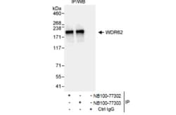 WDR62 Antibody, Novus Biologicals 100 &mu;L | Buy Online | Novus Biologicals | Fisher Scientific