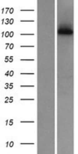 Novus Biologicals™ WDR63 Overexpression Lysate